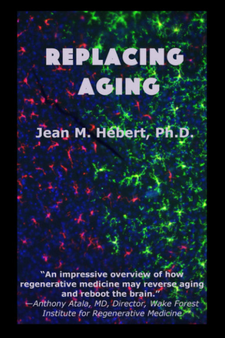 Replacing Aging
