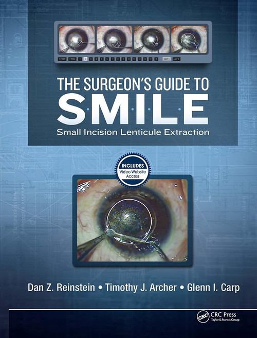 The Surgeon's Guide to SMILE: Small Incision Lenticule Extraction