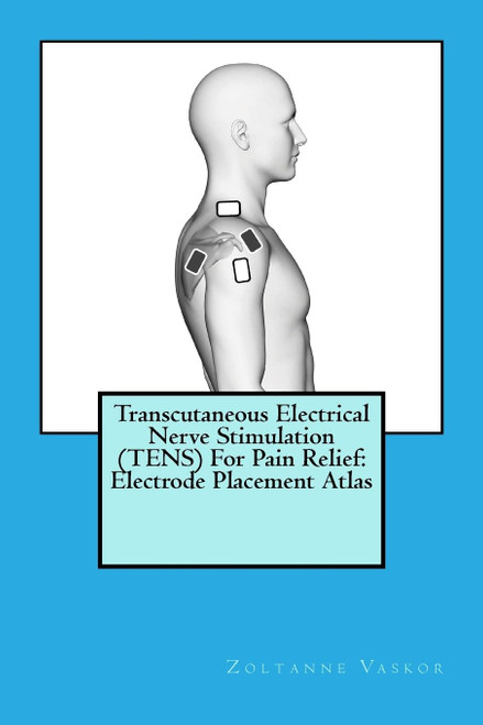 Transcutaneous Electrical Nerve Stimulation