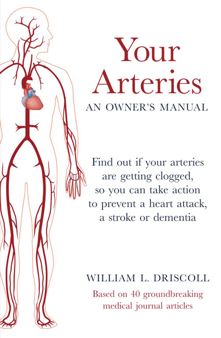 Your Arteries-An Owner's Manual: Find Out If Your Arteries Are Getting