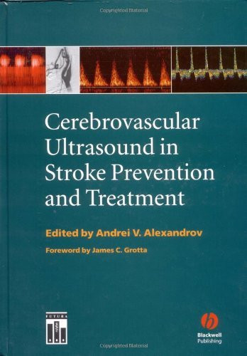 Cerebrovascular Ultrasound In Stroke Prevention And Treatment