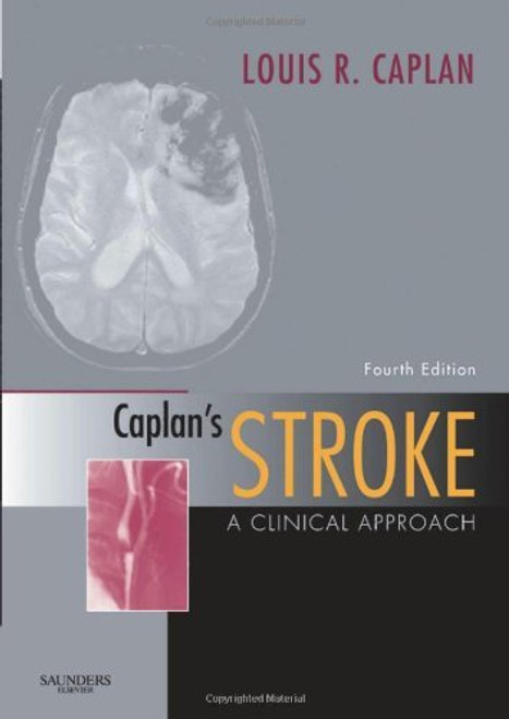 Caplan's Stroke