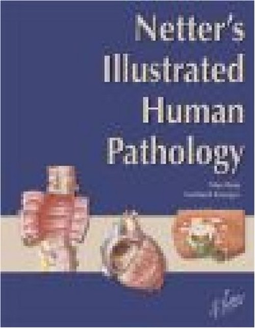 Netter's Illustrated Human Pathology