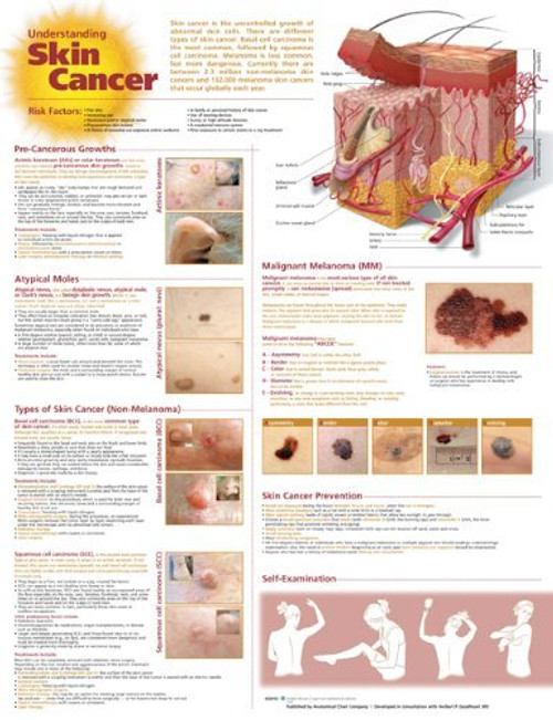 Understanding Skin Cancer Anatomical Chart