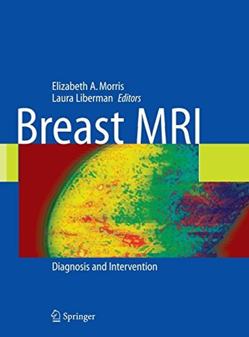 Breast MRI