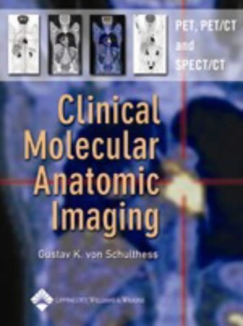 Molecular Anatomic Imaging