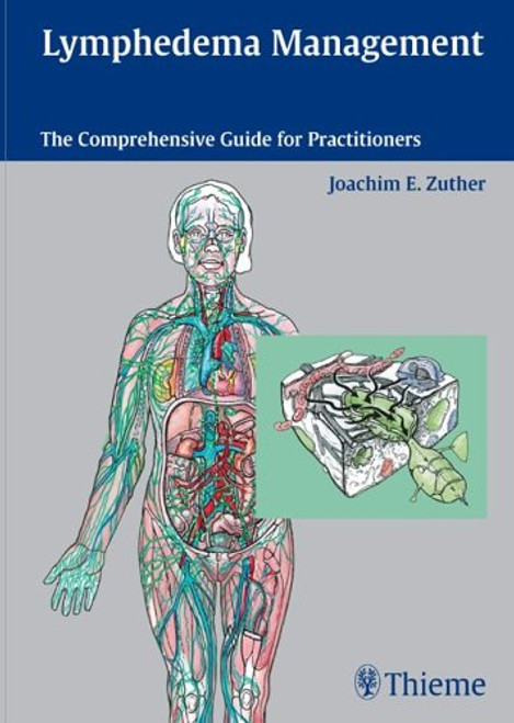 Lymphedema Management