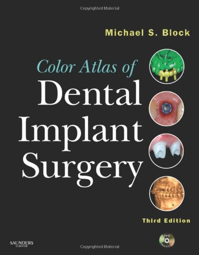 Color Atlas of Dental Implant Surgery