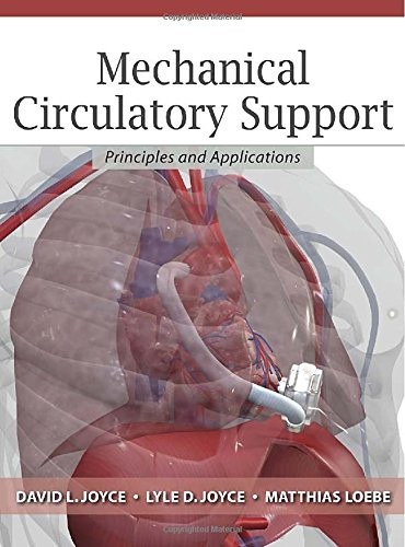 Mechanical Circulatory Support