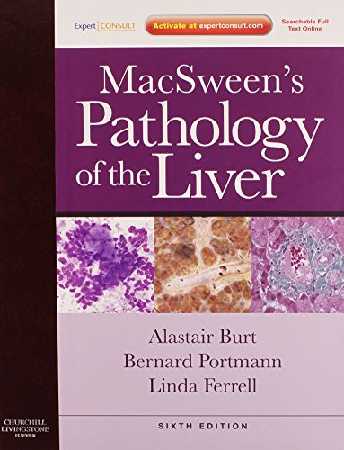 Macsween's Pathology of the Liver