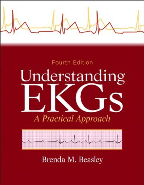 Understanding Ekgs