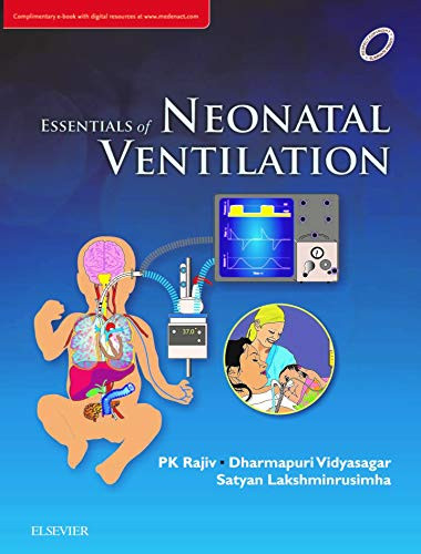 Essentials of Neonatal Ventilation 1st edition