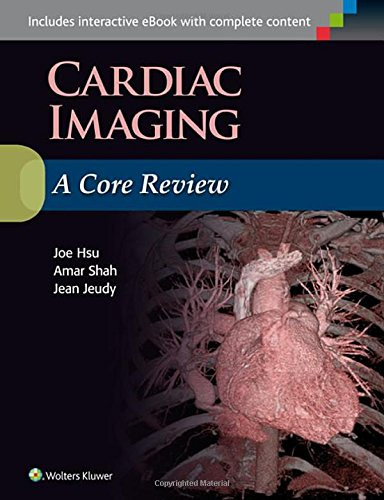 Cardiac Imaging