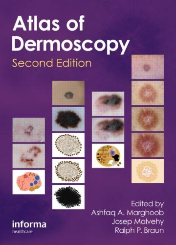 Atlas of Dermoscopy