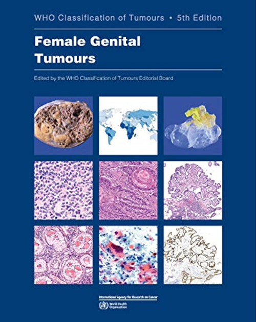 Female Genital Tumours: WHO Classification of Tumours
