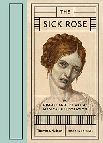 Sick Rose Disease and the Art of Medical Illustration /anglais
