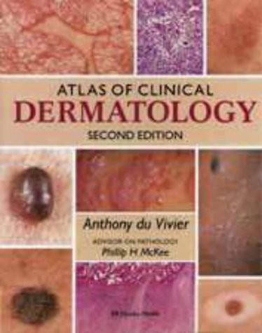 Atlas of Clinical Dermatology