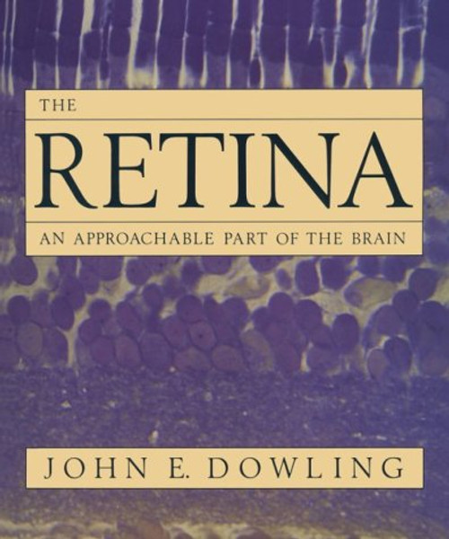 Retina: An Approachable Part of the Brain