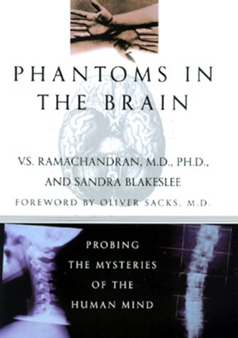 Phantoms in the Brain