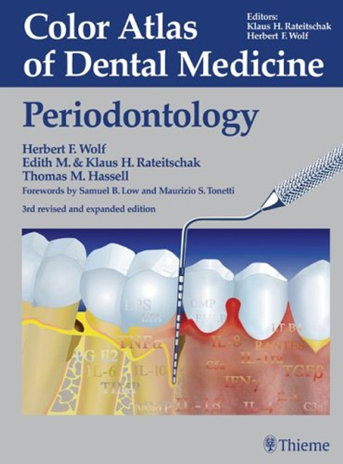 Color Atlas of Dental Medicine: Periodontology