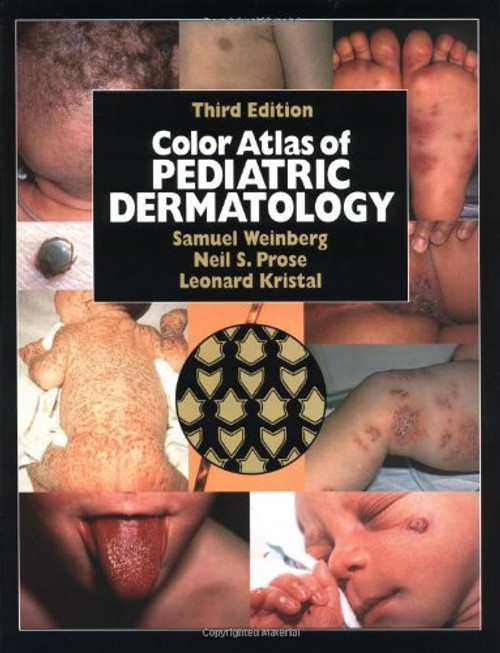 Color Atlas of Pediatric Dermatology