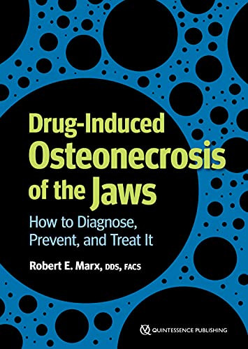 Drug-induced Osteonecrosis of the Jaws