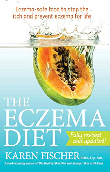 Eczema Diet: Eczema-safe food to stop the itch and prevent eczema