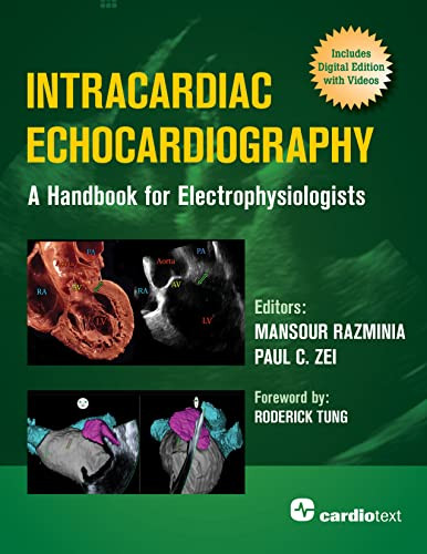 Intracardiac Echocardiography