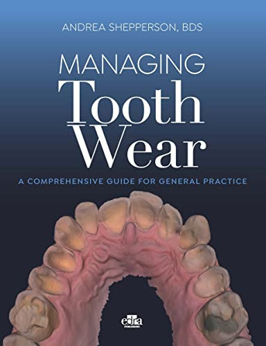 Managing Tooth Wear. A Comprehensive Guide For General Practice
