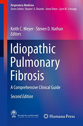 Idiopathic Pulmonary Fibrosis: A Comprehensive Clinical Guide