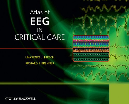 Hirsch and Brenner's Atlas of EEG in Critical Care