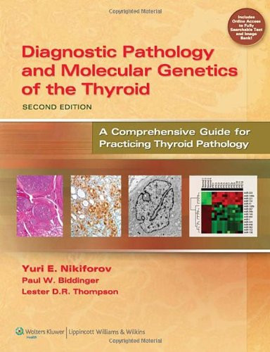 Diagnostic Pathology and Molecular Genetics of the Thyroid