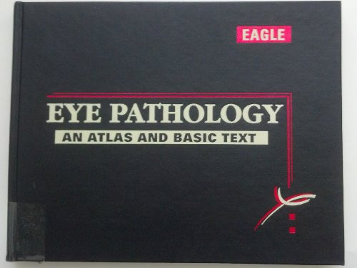 Eye Pathology