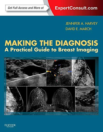 Making the Diagnosis: A Practical Guide to Breast Imaging: Expert