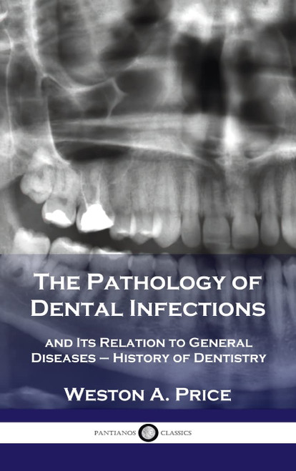 Pathology of Dental Infections: and Its Relation to General Diseases