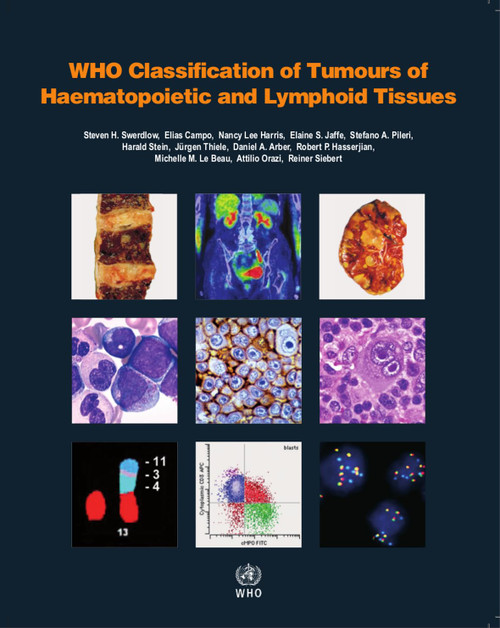 WHO Classification of Tumours of Haematopoietic and Lymphoid Tissues