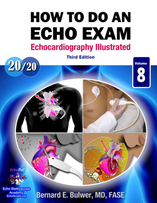 How to Do An Echo Exam: (Echocardiography Illustrated)