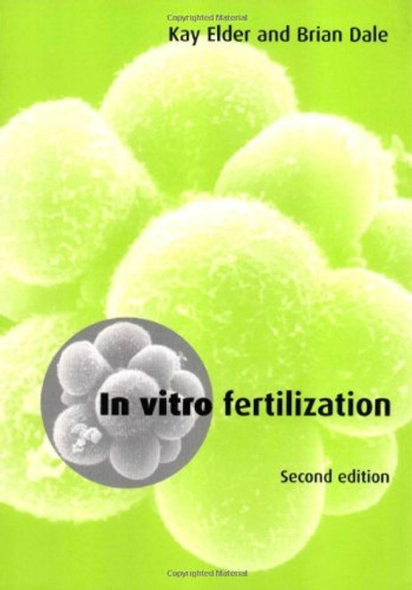 In Vitro Fertilization