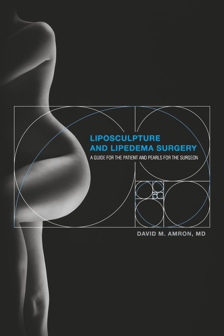 Liposculpture and Lipedema Surgery: A Guide for the Patient and