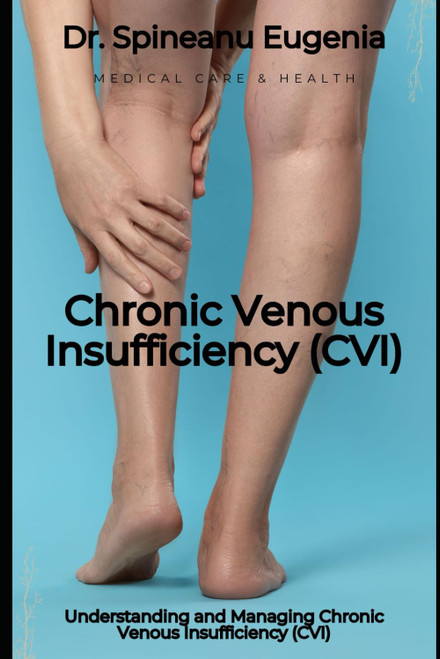 Understanding and Managing Chronic Venous Insufficiency (CVI)