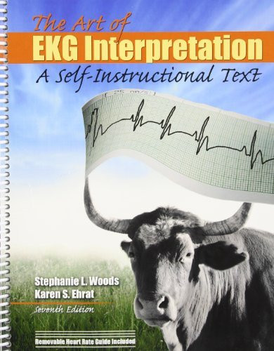 Art Of Ekg Interpretation