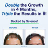 Patented Hair Growth Vitamins for Women & Men | Clinically Proven Hair Loss Supplement for Visibly Thicker Fuller Hair | Dr. Recommended Hair Vitamin