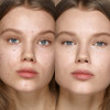 KIKO Milano Full Coverage Concealer 01 | Very High Coverage Concealer