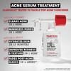 Thayers Double Action Acne Serum with Salicylic Acid, Acne Treatment Face Serum with 2% Salicylic Acid and Niacinamide, Soothing and Non-Stripping Sk
