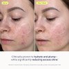 Skinfix Skin Barrier Restoring Gel Cream - 1.7 oz - Non-Greasy Moisturizer for Normal to Combination Skin - Hydrates, Plumps & Smooths - Non-Comedoge
