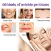 Face and Forehead Wrinkle Patches, 100pcs Face Lift Tape Invisible Anti Wrinkle Patches to Reduce Fine Wrinkles, Frown and Smile Lines, Overnight Wri