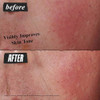 Kiehl's Ultra Facial Advanced Repair Barrier Cream, Intensive Treatment Relieves Dry + Sensitive Skin, Rapidly Reduces Redness and Soothes, Fast-Abso