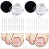 60 Pieces Ingrown Toenail Corrector Strips Ingrown Toe Nail Correction Brace Correction Clip Toe Nail Straightening Recover Patch Curved Toenail Corr