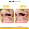 120g Wax Nose Wax Kit, Nose Hair Wax Kit with 40 Applicators, Quick & Painless Nose Waxing Kit for Men and Women, Nose Hair Remover Kits Used 20 Time