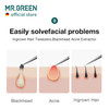 MR.GREEN Ingrown Hair Tweezers Needle Nose Pointed Tips Tweezers For Eyebrows Splinters Blackhead Removal Acne Clip Extractor (Long)